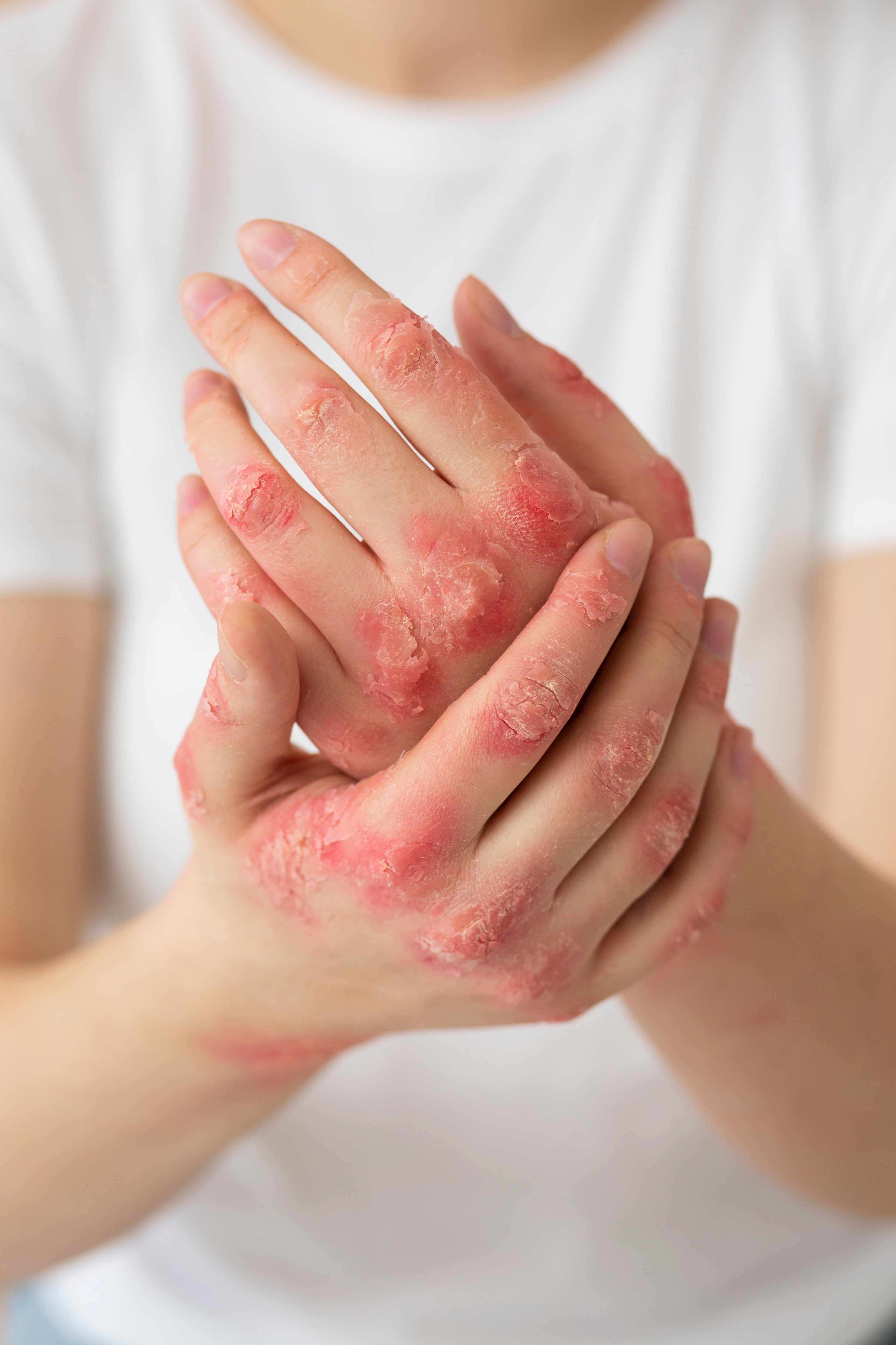 Itchy, Irritated Skin