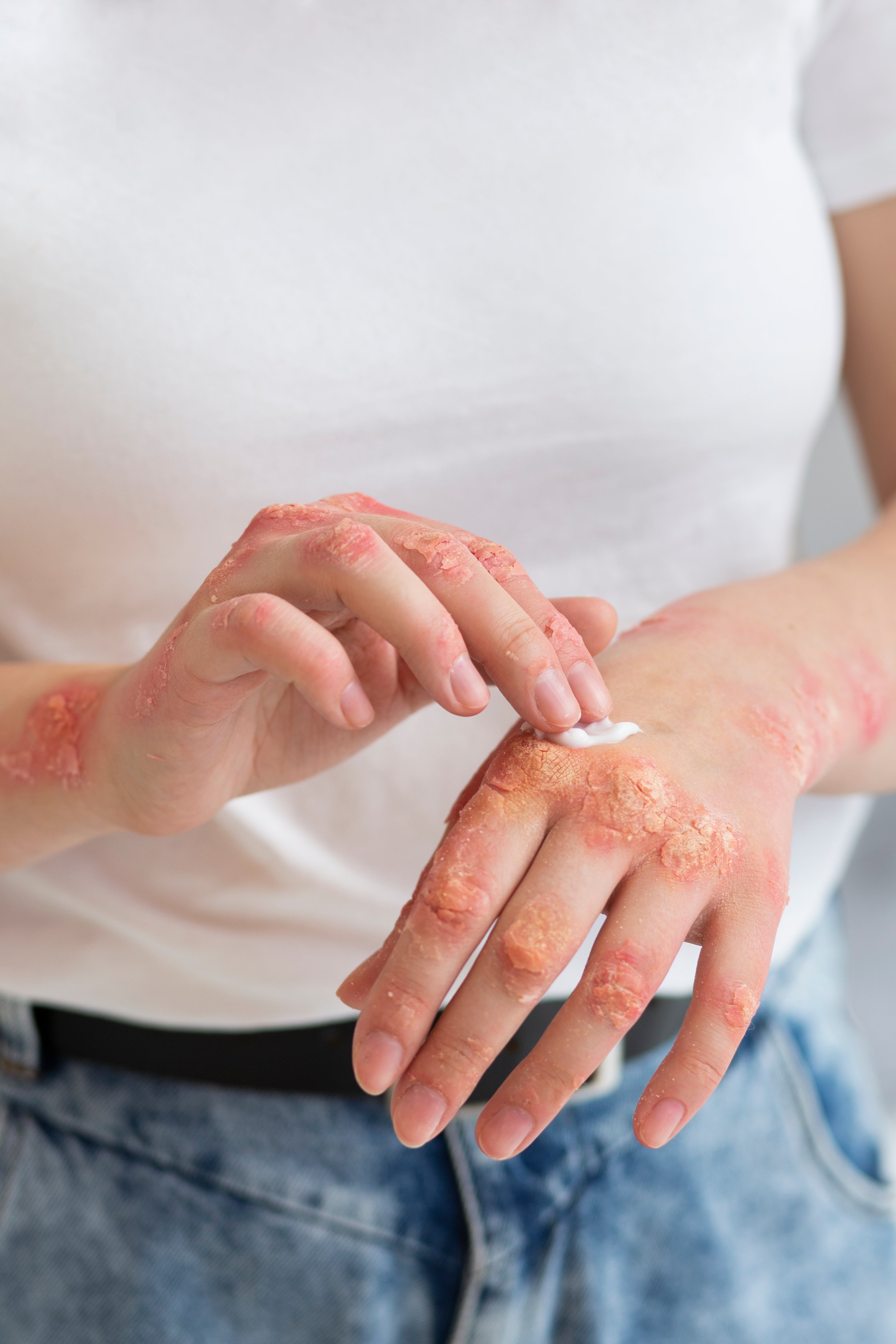 Damaged & Sensitive Skin