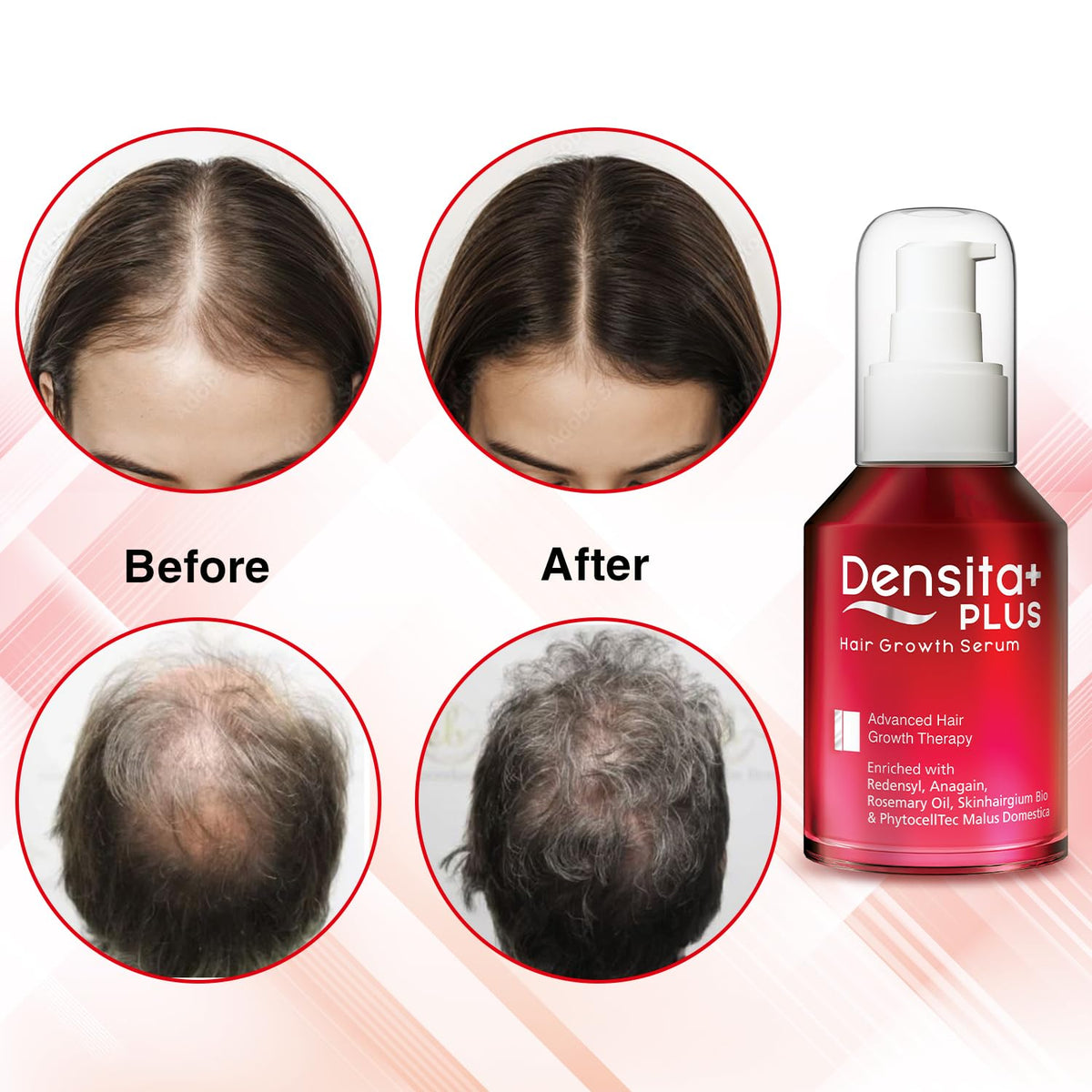 Densita Plus Hair Growth Serum | With Redensyl, Anagain & Rosemary Oil | Helps Reduce Hair Fall, Strengthens Hair & Supports Healthy Growth | 60 ml - Skiynse Dermatologique