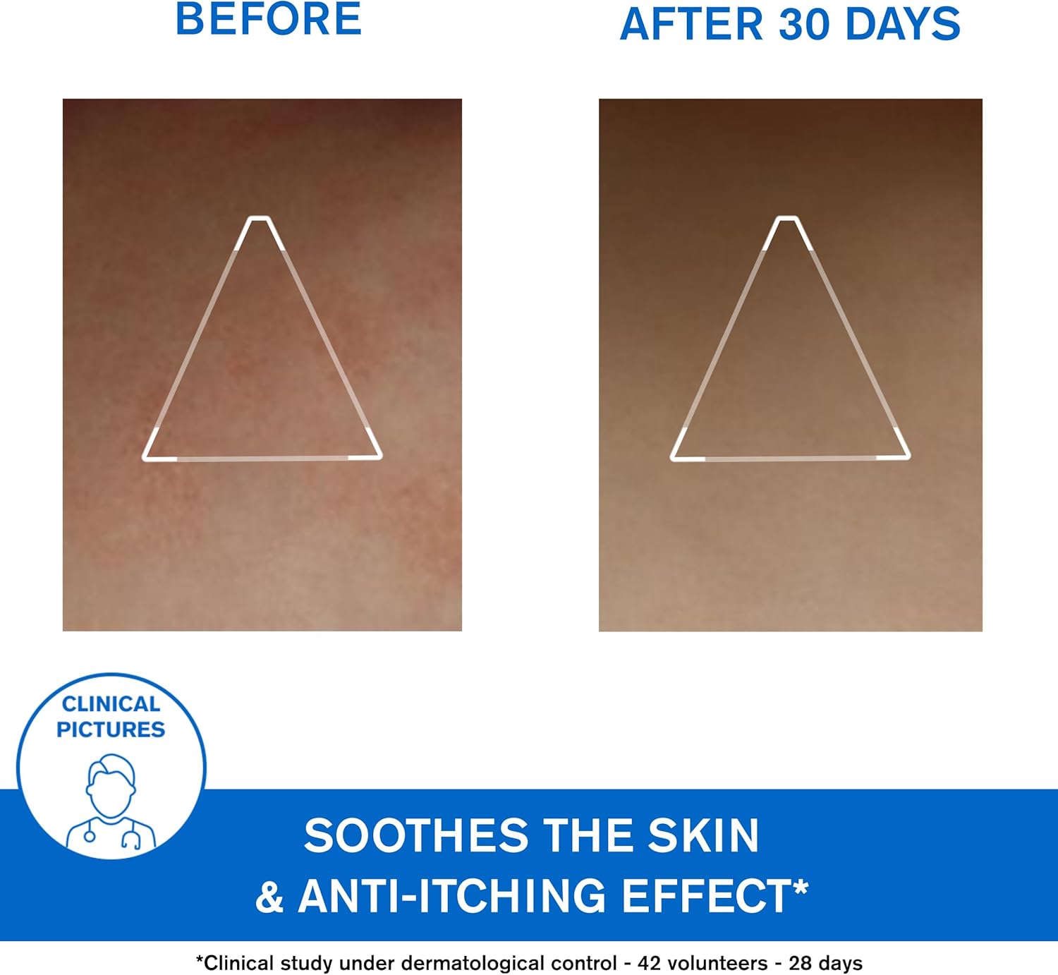 Uriage Xemose Anti-Irritation Relipidating Cerate 200 ml