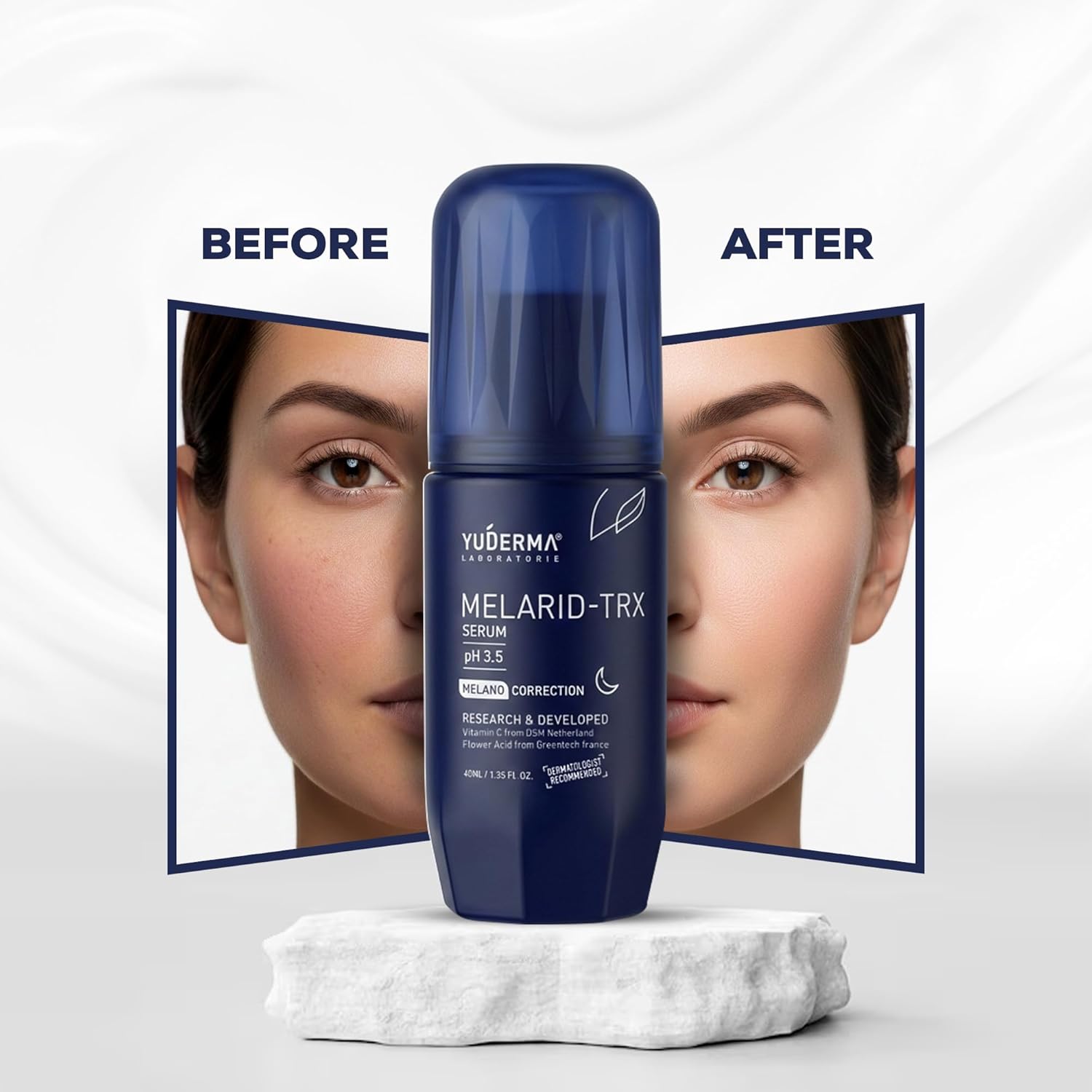 Melarid Dark Spot Correcting Serum – TRX Serum pH 3.5 – For Melano Correction & Pigmentation – For Uneven Skin Tone, 40ml