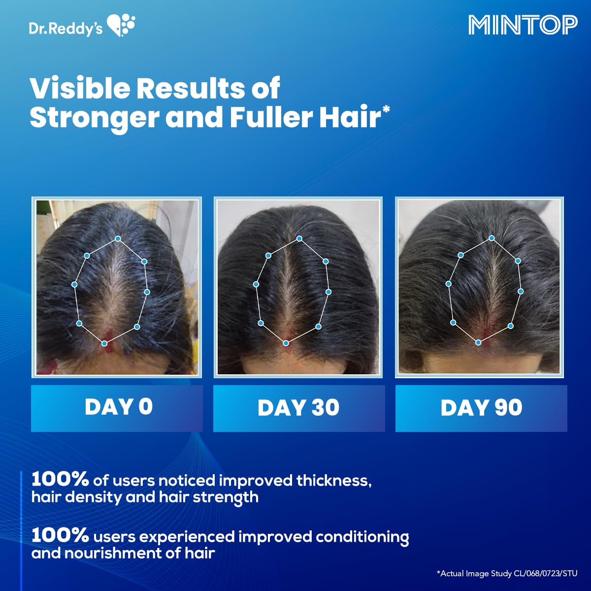 Mintop Pro Plus| Hair Regrowth Serum by Dr Reddys|Fortified with Redensyl, Procapil, Biotin and Copexil| Proven Hair Fall Control| Scalp Nutrition| 50 Ml - Skiynse Dermatologique