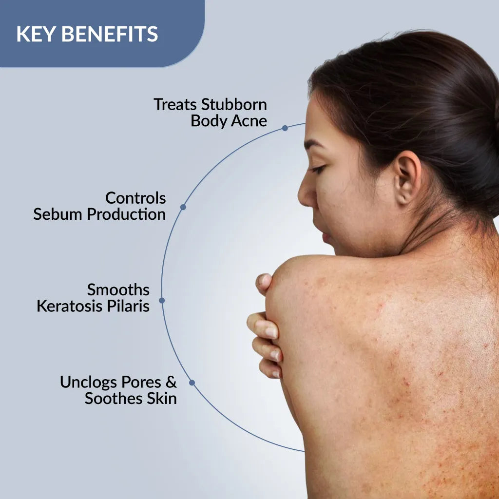 Salyzap-AZ Body Spray, 100 ml | An Innovative 360° Spray for Back & Body Acne